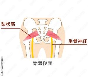 写真 腰痛 座骨神経 5 梨状筋！ (300x262) に縮小