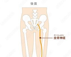 写真 腰痛 座骨神経 1 (2) (250x200) に縮小
